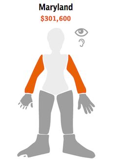 Maryland Workers Comp Arm Injury Value ProPublica